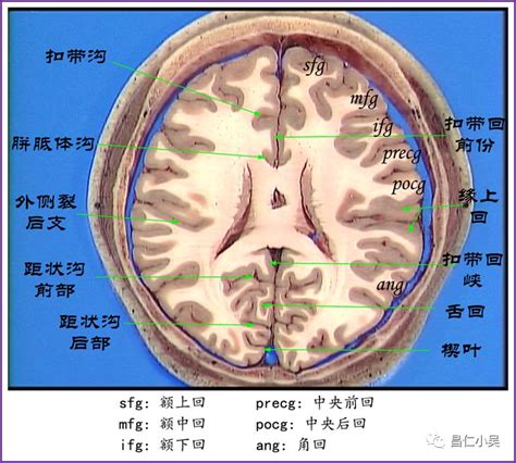 禽距裂|神经解剖学习笔记：脑回、脑沟